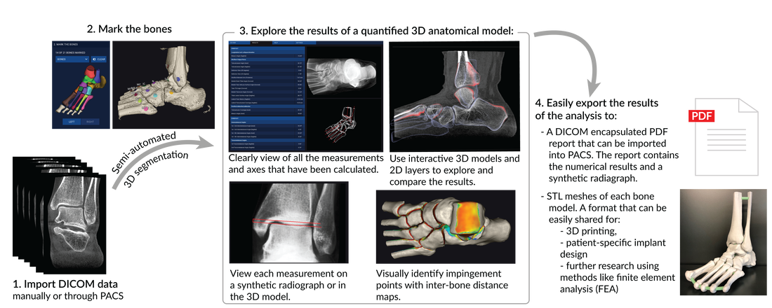 Automated analysis of medical images with Bonelogic software