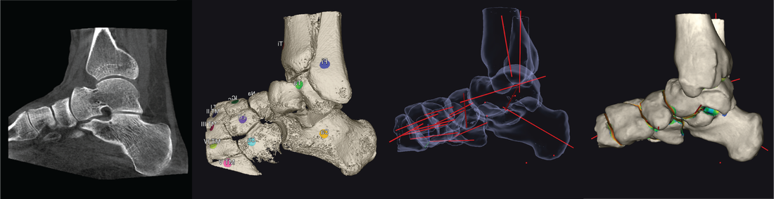 Healthcare imaging data is processed to give 3D models and measurements 